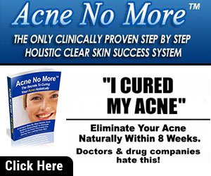 acne no more