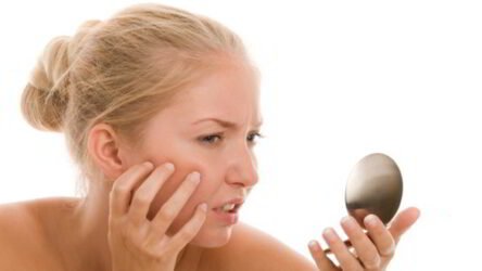 How Can You Get Rid of Acne Scars Naturally – In 3 Weeks